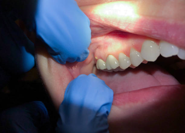 Best Pediatric Emergency Dentist in Rosedale, LA